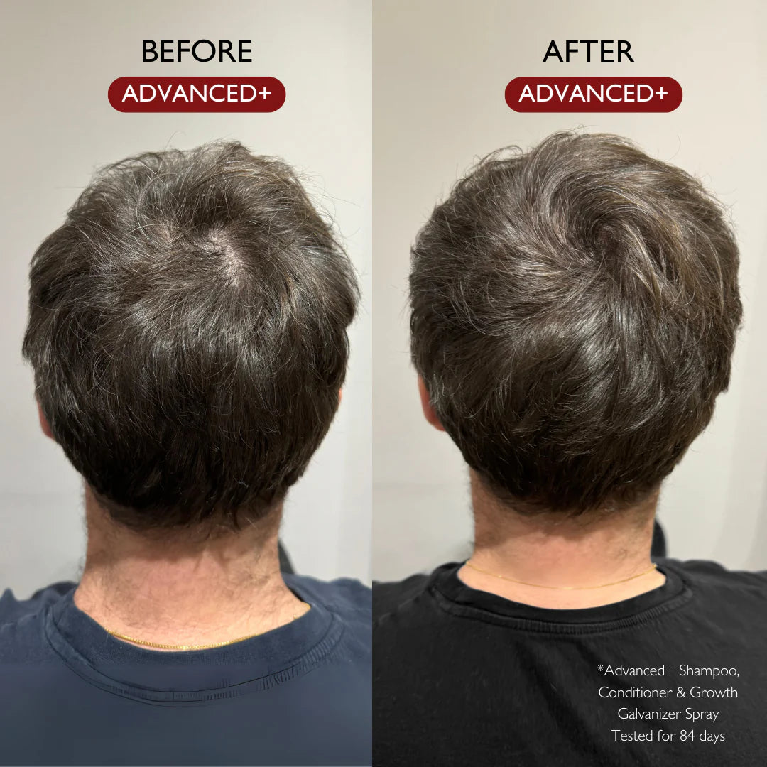 ADVANCED+ CONDITIONER